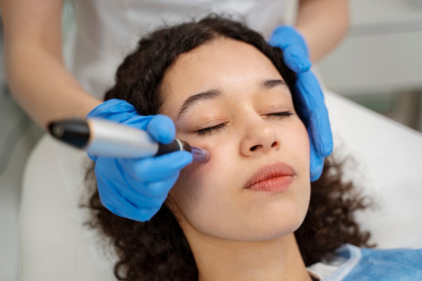 Is Microneedling the Secret to Radiant Skin in London?