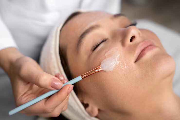 Chemical Peel Treatments