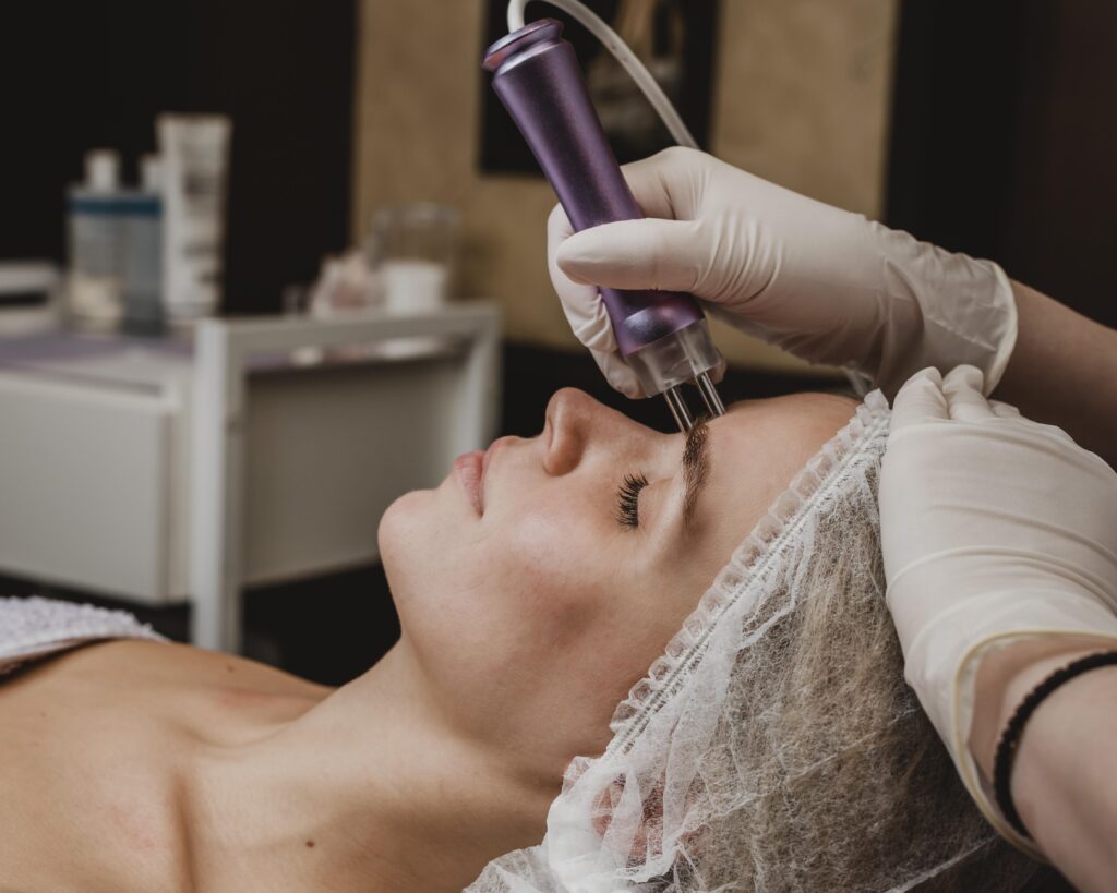 Is SQT Microneedling Safe for Sensitive Skin? Expert Insights from Medusa Beauty Zone, Shoreditch